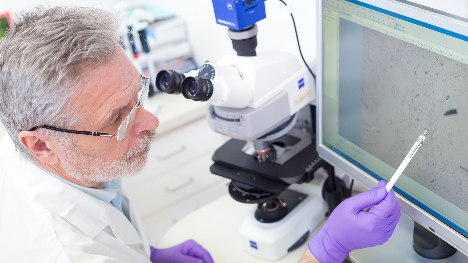 La metilbenzofonona puede ser cancerígena